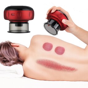 Electric Cupping Massager Manufacturer - Smart Vacuum Therapy Guasha Hijama Cups OEM Cellulite