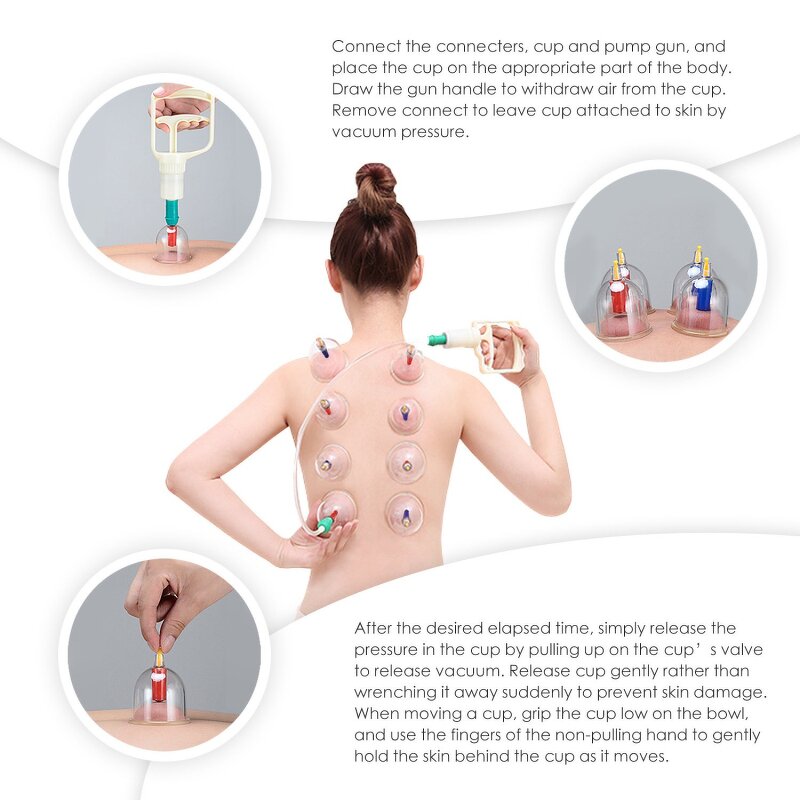 Cupping Therapy Cups Kit Manufacturer - 24 Ventouse Vacuum Manual Disposable Set with Customized Logo Box