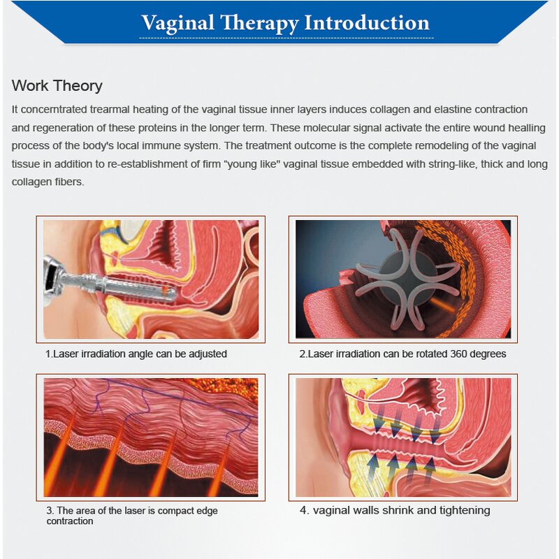 Fractional CO2 Laser Machine Manufacturer - 2025 Newest Portable 10600nm Skin Rejuvenation Anti-Aging Wrinkle Removal Device