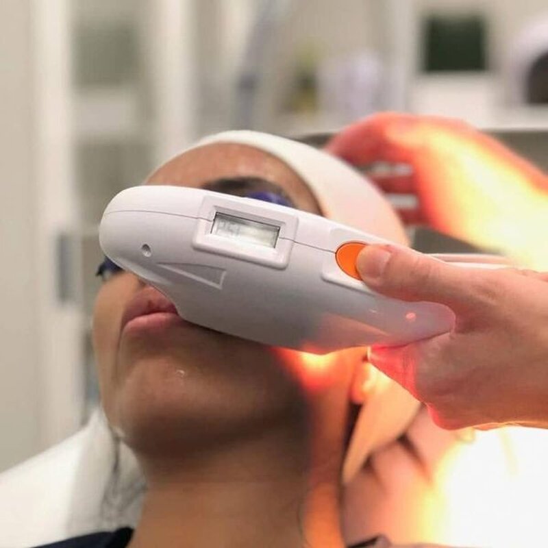 Elight Opt IPL Machine - 2025 Laser Beauty Equipment for Permanent Hair Removal Salon Use