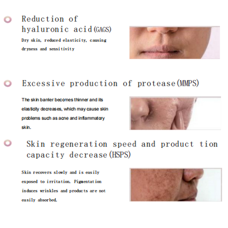 Plasma Treatment Machine - 40% Wound Reduction Bacteria Inflammatory Acne Skin Allergies Eczema LED Desktop