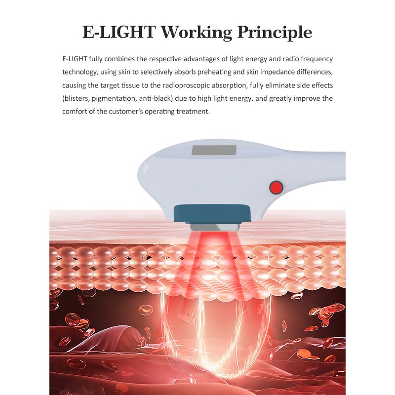 3 in 1 Opt Beauty Machine - E Light IPL RF Nd Yag Laser Hair Tattoo Removal Face Lifting Pico Laser