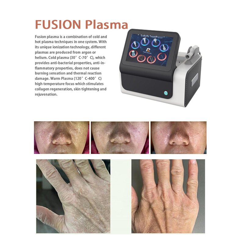 Fractional Fibroblast Plasma - Professional Cool Jet Pen ABS Standing US Cool Face Whitening Salon Device