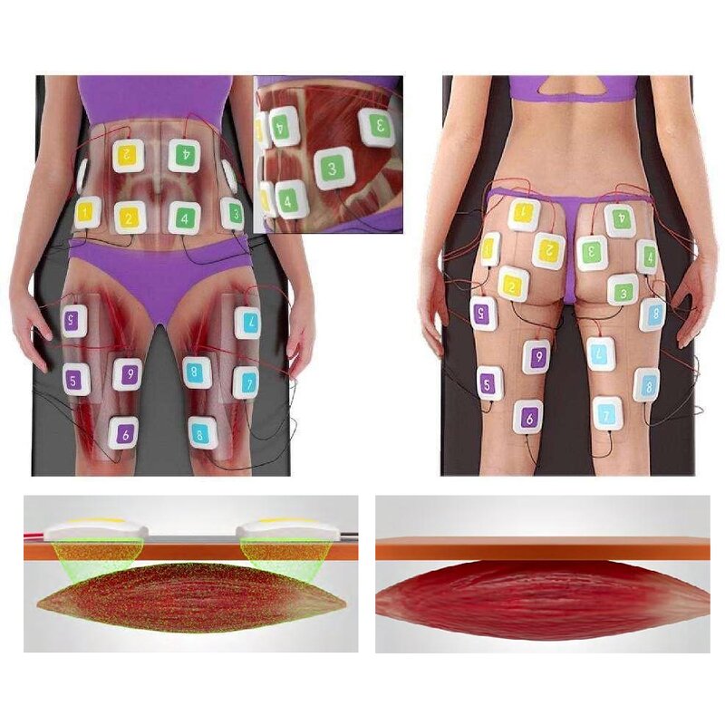 EMS Body Shaping Machine Manufacturer - Wholesale Electronic Muscle Stimulator Hand Firming Weight Loss Standing ABS