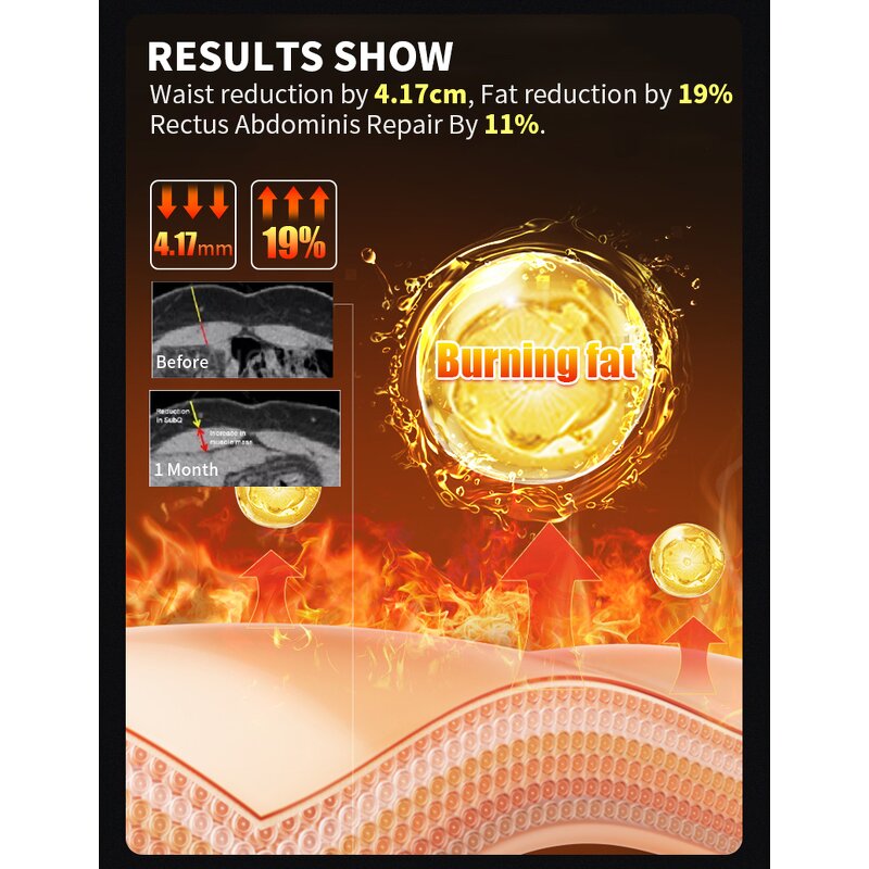 EMS Body Sculpting Machine Manufacturer - High Frequency 200hz 4 Handles Muscle Building Fat Burning Salon Device