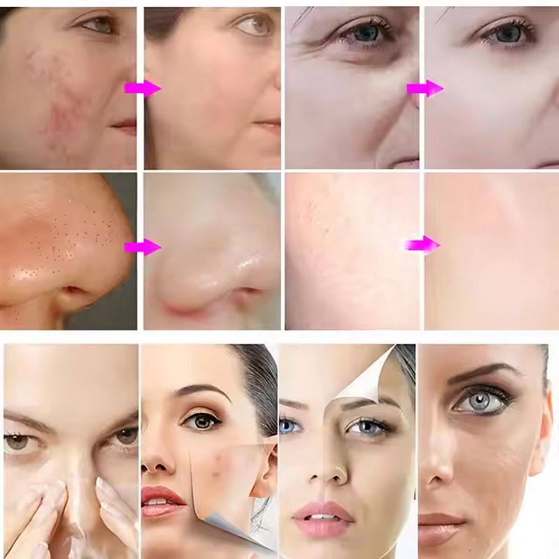 Dynamic Oxygen Bubbles Kit - High Frequency Facial Anti-Aging Hydrotoning Moisturizing Detoxification Repair