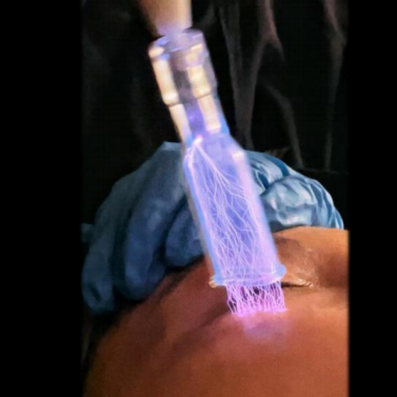 Plasma LED Machine - Latest Desktop Cosmetic Treatment Reduces Anti-Aging Infection Control Salon Equipment