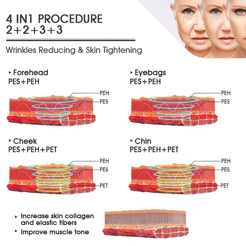 RF EMS Anti-Aging Machine - Professional Non-Invasive Radio Frequency Skin Lift Neck Eye Feet US/IT/ZA/CN