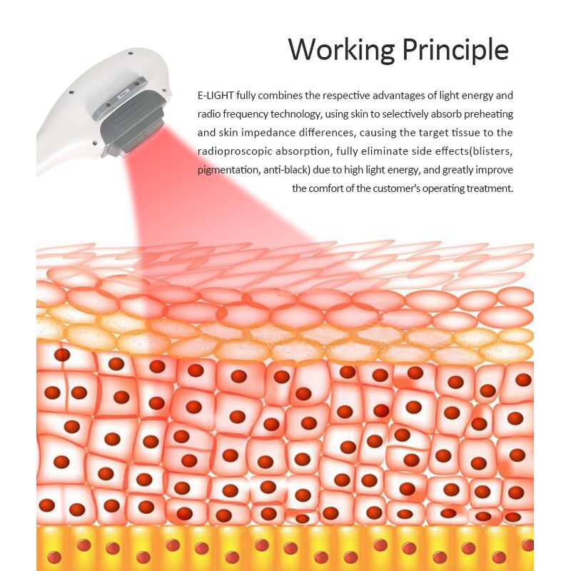 Elight IPL OPT Machine - Multifunction Hair Removal Skin Rejuvenation RF Face Body UK/US Plug Salon Equipment