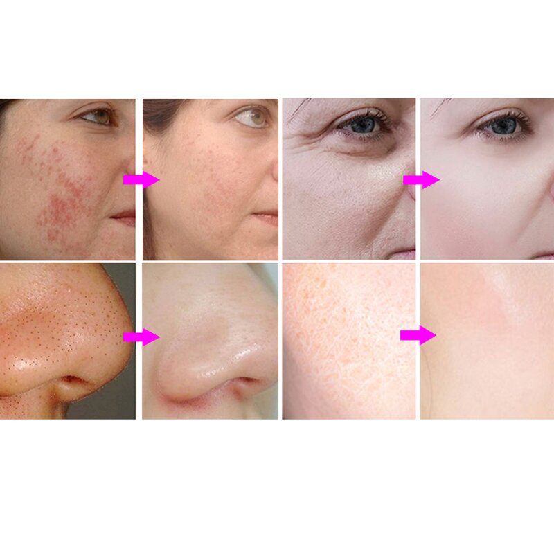 Small Bubble Facial Instrument Manufacturer - Portable 10 in 1 Oxygen Jet Facial Beauty Device