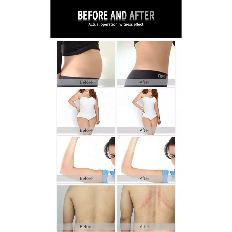 RF Slimming Machine Manufacturer - Multi-functional Fat Burning Skin Firming Body Shaping Weight Loss Device