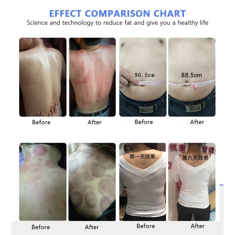 Body Care Machine Manufacturer - Multi-functional Beauty Health Care Device