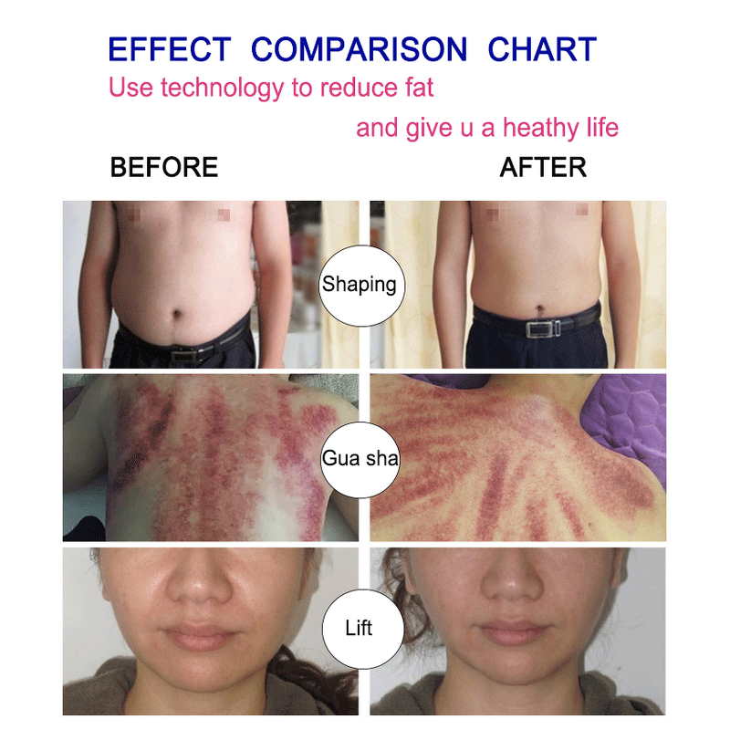 RF Slimming Device Manufacturer - 2024 New Microwave Nano Fat Burning Skin Firming Body Shaping Weight Loss Machine