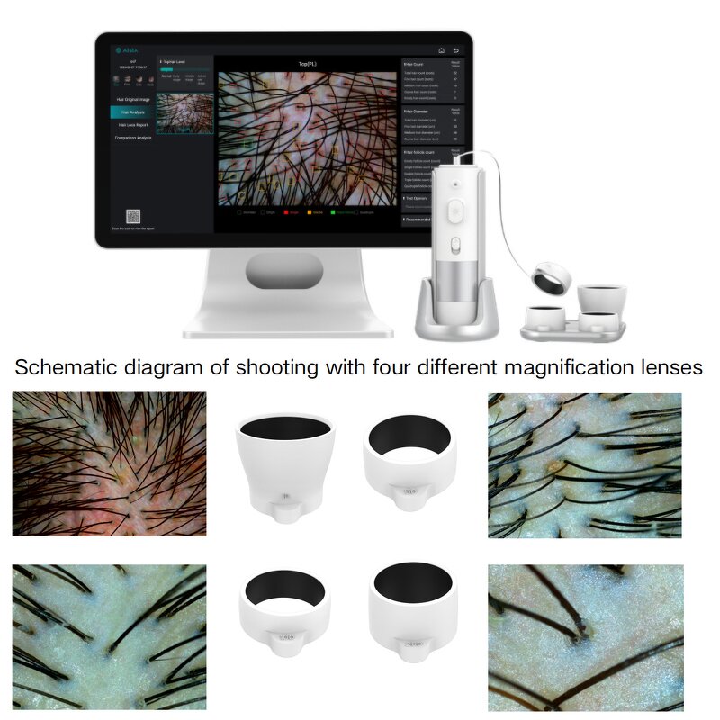 15.6 Inch AI Hair Skin Analyzer Manufacturer - 2025 Wireless Desktop USB Cloud Data Storage Magnifying Tool