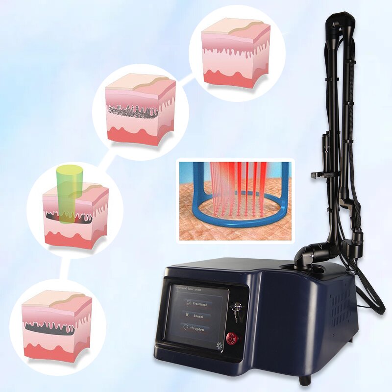 Fractional CO2 Laser Machine Manufacturer - Pigmented Scar Stretch Mark LCD High Energy Density Device