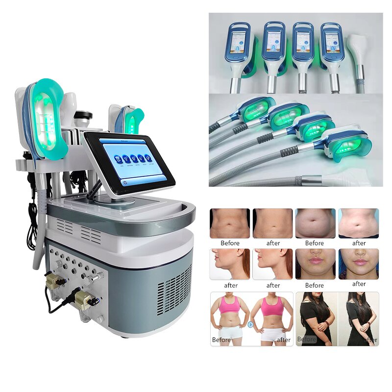 360° Cryo Cooling Cup Machine Manufacturer - New Technology Lipo Laser Face Body RF Weight Loss Tool