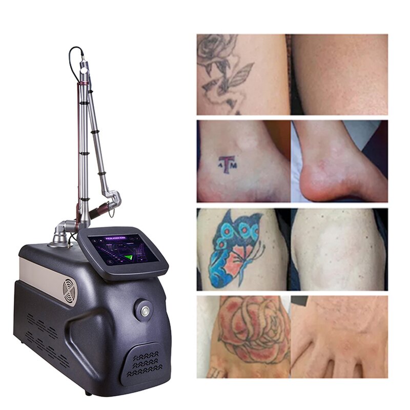 Portable CO2 Laser Machine Manufacturer - 2000MJ Q Switch 4 Wavelength Tattoo Removal Beauty Device