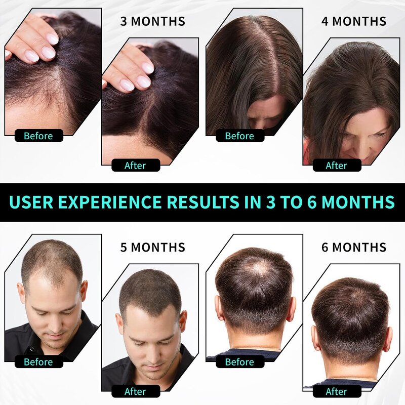 Scalp Massager Manufacturer - Rechargeable Home Use USB Electric Hair Growth Comb