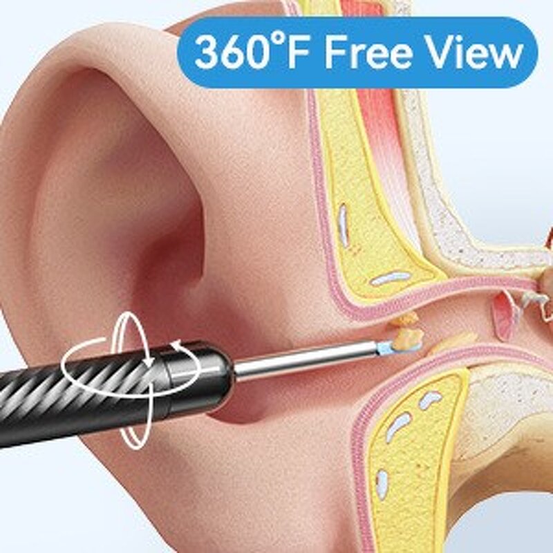 Wireless Wifi Ear Endoscope Manufacturer - Visual Ear Wax Remover IOS Android Smart Ear Cleaner Tool