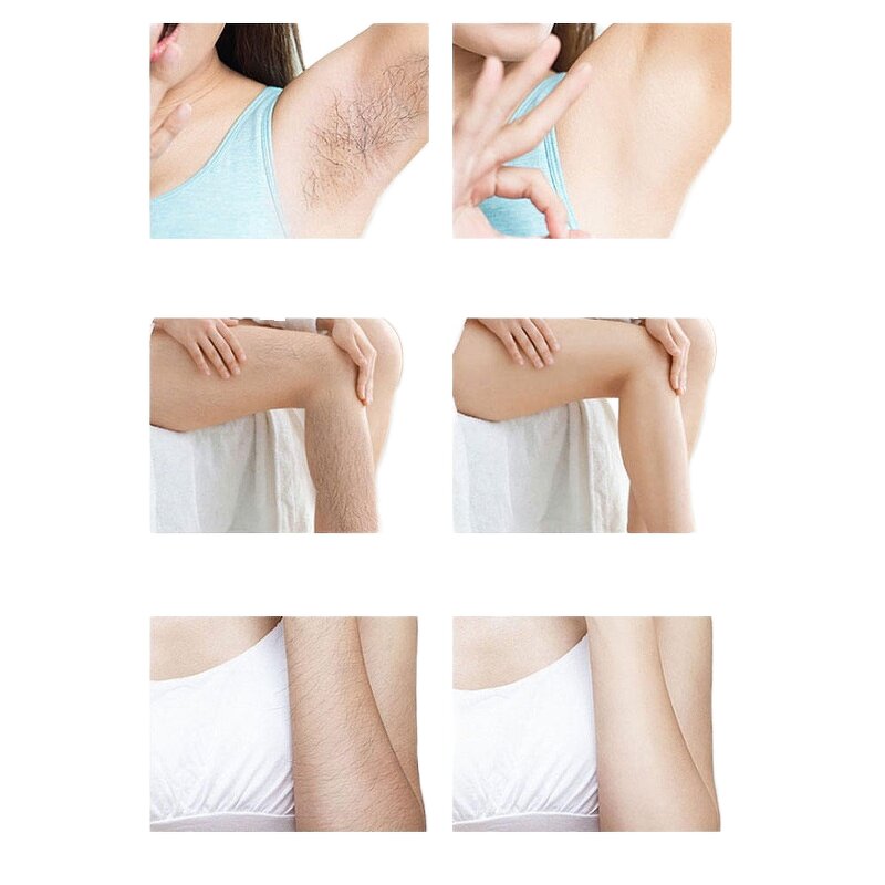 Portable IPL Hair Removal Handset Manufacturer - 2024 Ice Cooling Depilation Laser Hair Removal Device