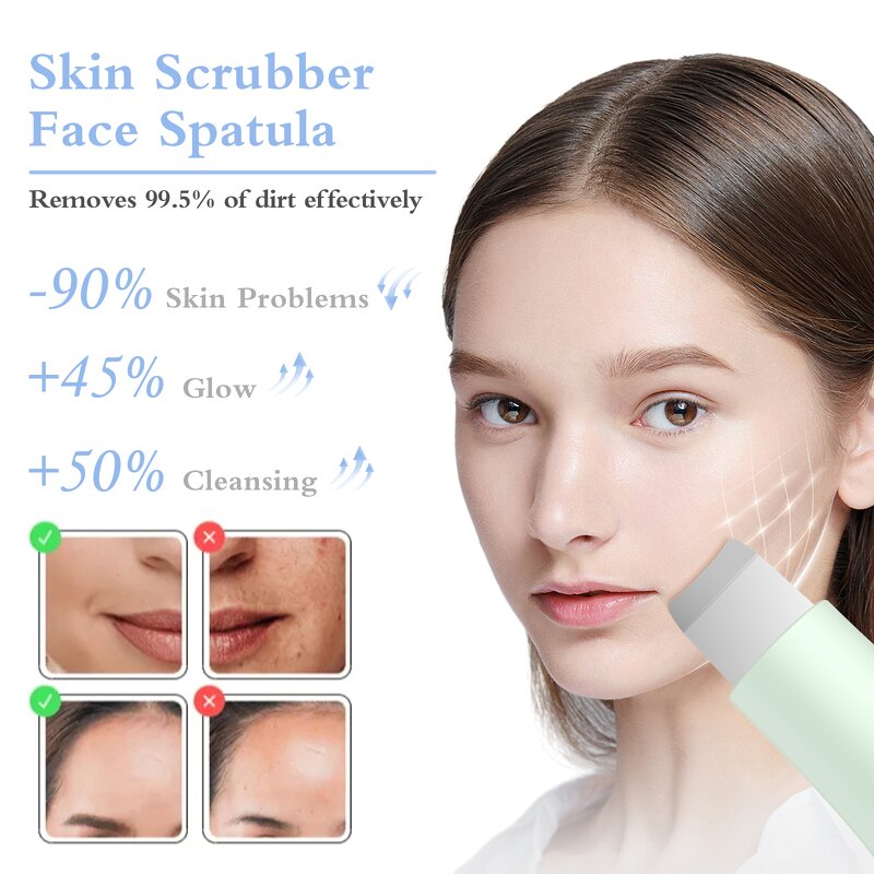 Dual-Mode Blackhead Remover Manufacturer - Handheld Skin Scrubber Face Spatula Deep Cleansing Skin Care Tool