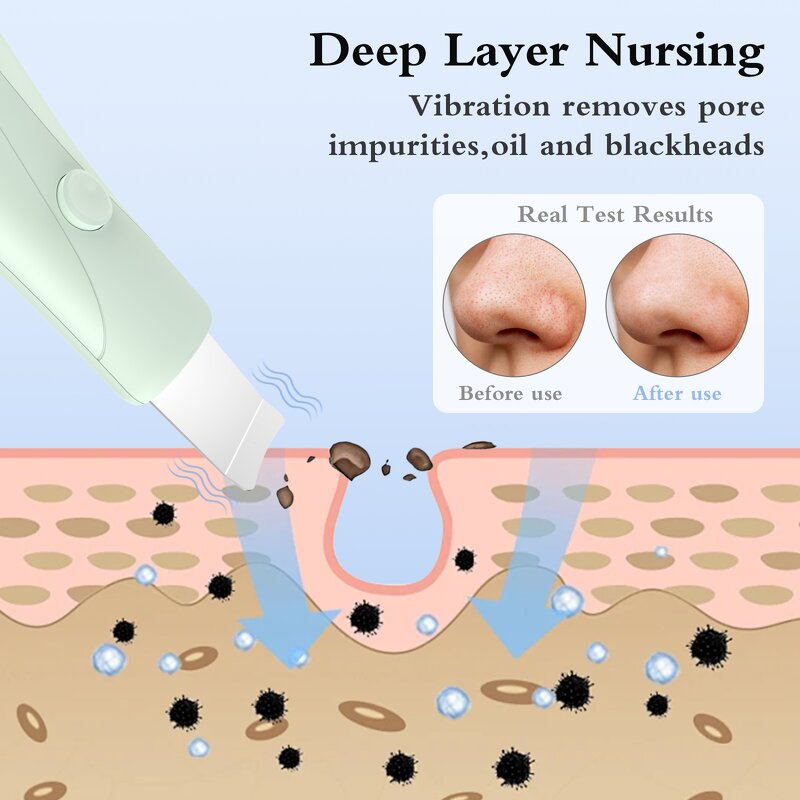 Dual-Mode Blackhead Remover Manufacturer - Handheld Skin Scrubber Face Spatula Deep Cleansing Skin Care Tool