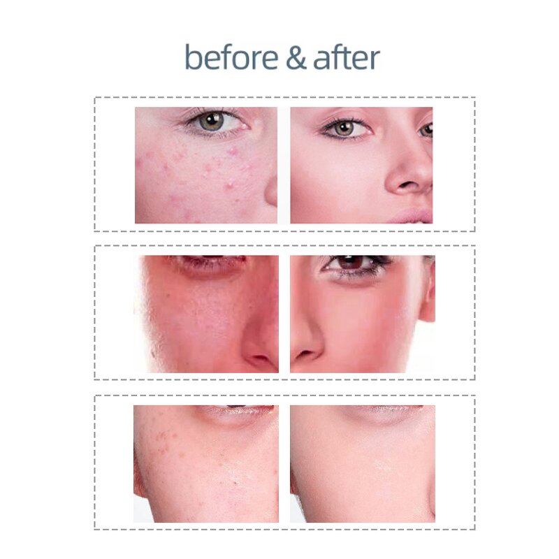 LED Photon Therapy Machine Manufacturer - 2026 Red Blue Near Infrared 7 Colors Anti Aging Facial PDT 12V/3A 32W Tool