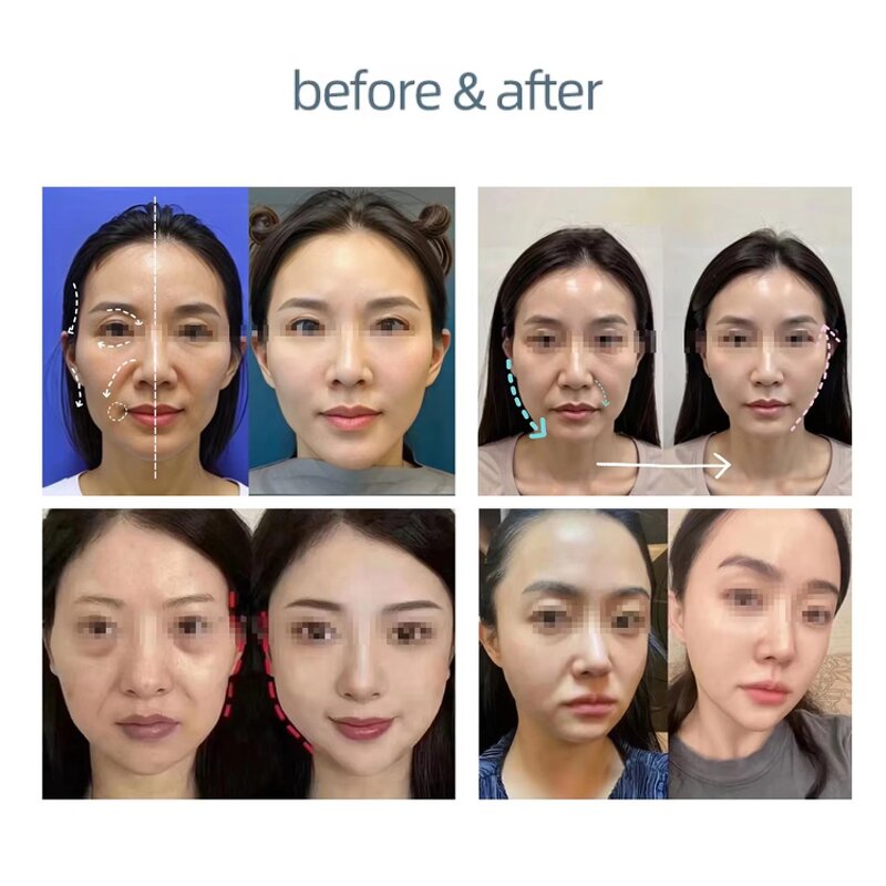 7 Color PDT Led Light Therapy Mask Manufacturer - Hot Facial Beauty Device Skin Rejuvenation Acne Care Machine