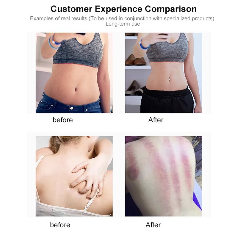 448kHz CET RET RF Machine Manufacturer - Portable 3-in-1 Facial Lifting Body Slimming Deep Heat Physiotherapy Tool