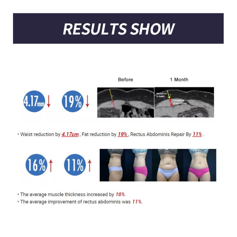 RF EMS Body Sculpting Machine Manufacturer - Non-Invasive 2/4 Handles Muscle Building Fat Loss Salon Beauty Equipment