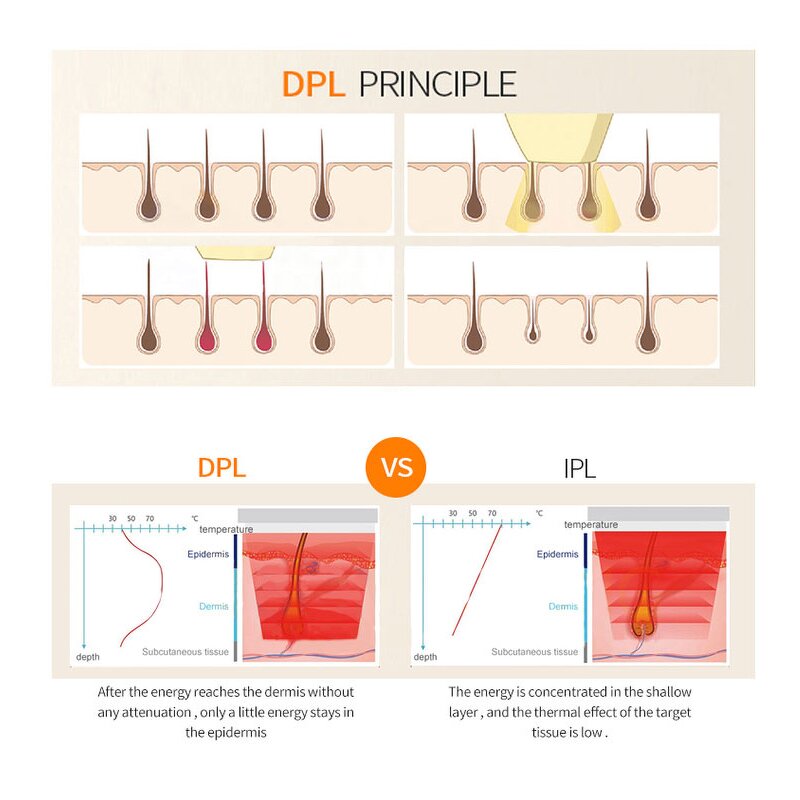 6 Wavelength IPL E-light Machine Manufacturer - New DPL Hair Removal LED Skin Rejuvenation Face Lift Body Tool