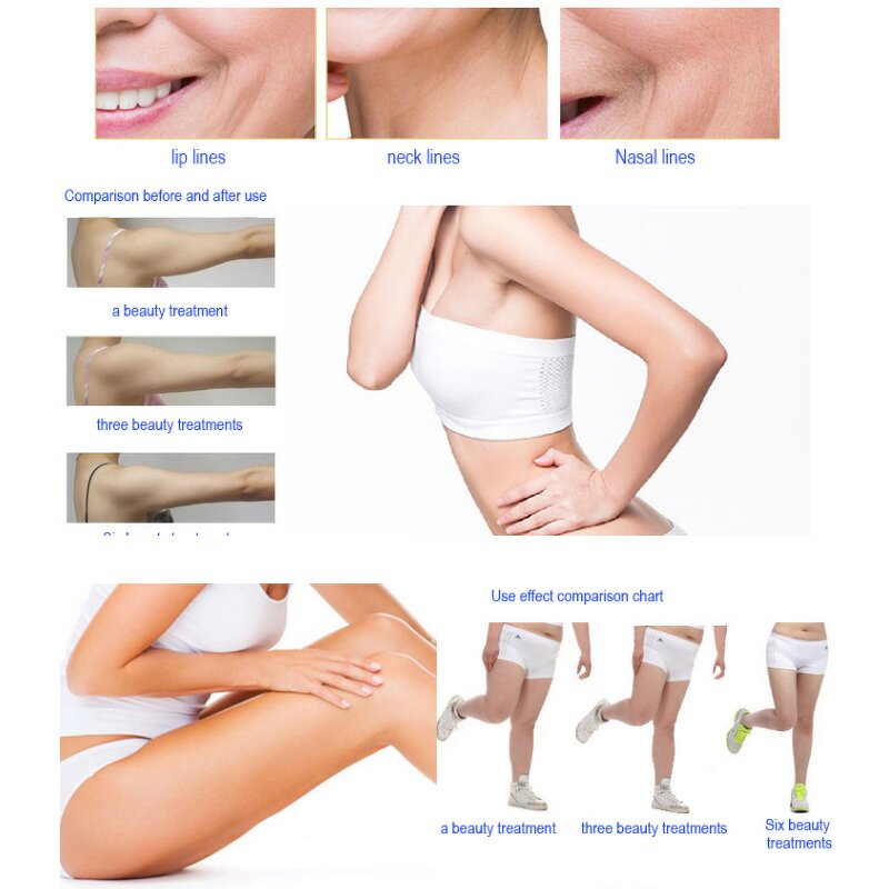 Excilift Ultra360 RF Machine Manufacturer - Factory Price Eye Bag Removal Monopolar Rf Skin Tightening Tool