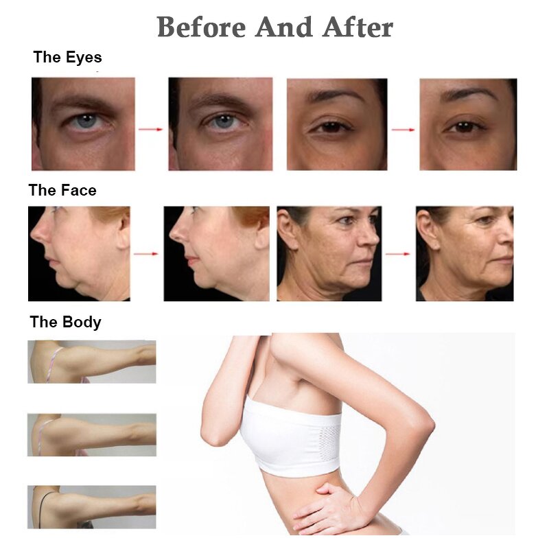 2in1 Monopolar Radio Frequency Machine Manufacturer - Professional 40.68MHz Thermal Face Lift Heat RF Tool