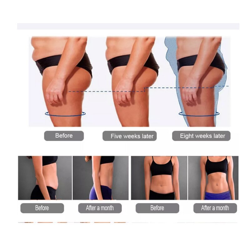 RF Slim EMS Muscle Stimulator Manufacturer - Hot Selling Face Lifting Skin Tightening Electromagnetic Body Sculpt Tool