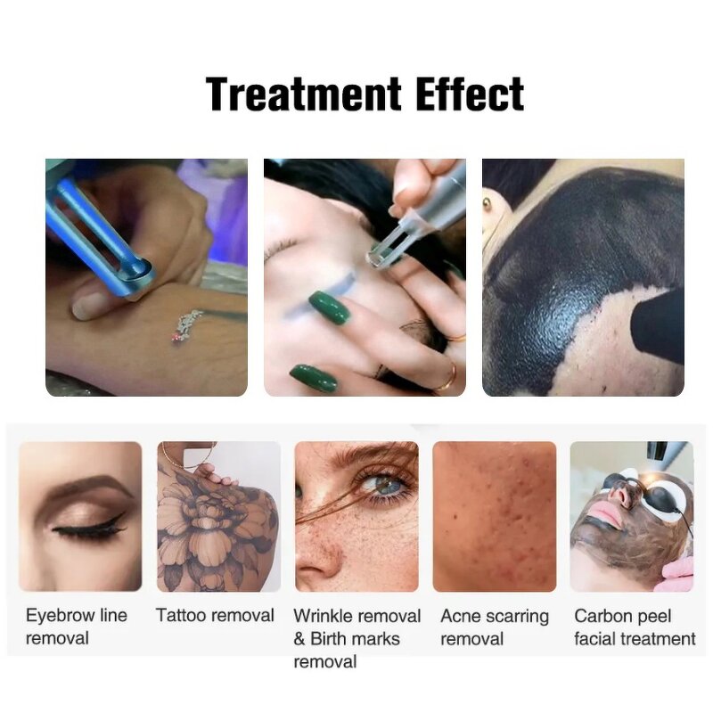 Mini Picosecond Laser Machine Manufacturer - 532/1064/1320nm Q Switched Nd Yag Portable Tattoo Removal Tool