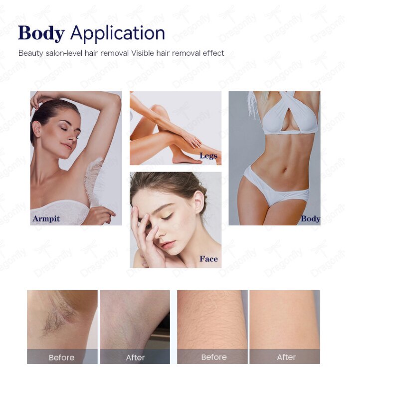 Portable 808nm Diode Laser Manufacturer - 1000W Iced Cooling 3-Wave Painless Long Lasting Depilation Tool