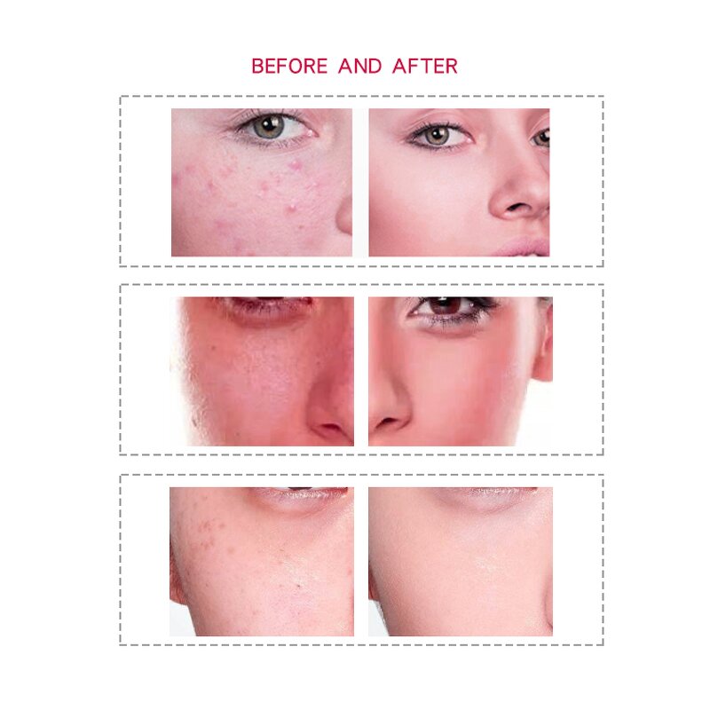 PDT Led Therapy Machine Manufacturer - Newest Photodynamic Facial Care Spa Skin Rejuvenation Beauty Equipment