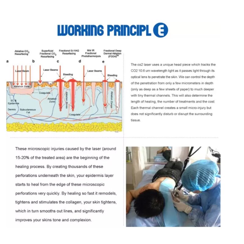 Fractional CO2 Laser Machine Manufacturer - Professional 60/80/100w Rf Tube Skin Resurfacing Scar Removal Tool
