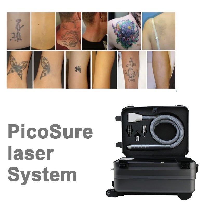 Portable Nd Yag Picosecond Laser Manufacturer - 532/1064/755nm 1000W Tattoo Removal Face Armpit Beauty Tool