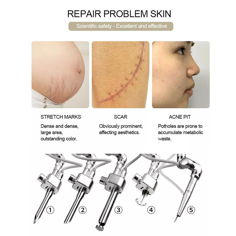 CO2 Fractional Laser Machine Manufacturer - Best Selling Vaginal Rejuvenation Skin Tightening Removal Treatment Tool