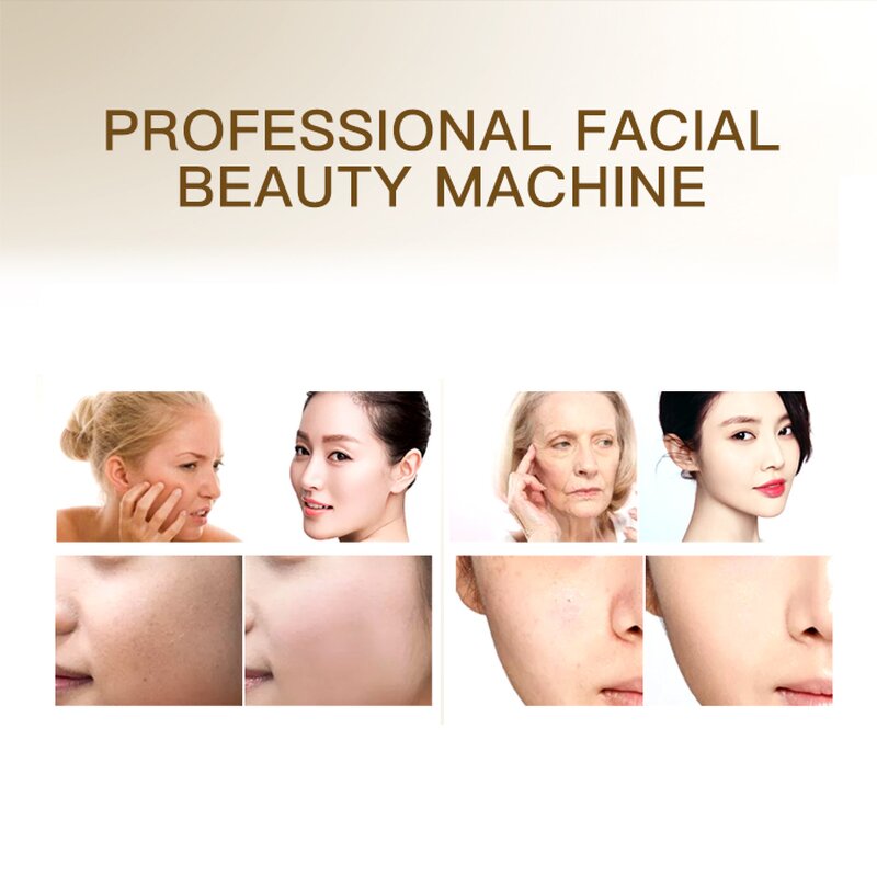 High Frequency Microcurrent Device Manufacturer - Facial Toning Bio RF Wrinkle Remover US ZA CN Plug Tool