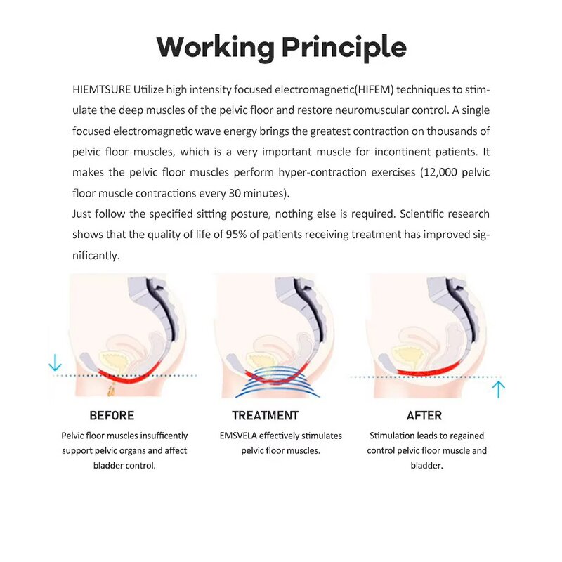 High-Intensity Magnetic EMS Pelvic Chair Manufacturer - LED US Women Urinary Incontinence Therapy Desktop Health Tool