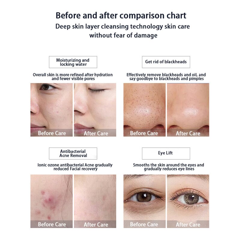 Beauty Care System Manufacturer - Integrated Total Large Bubble PDT Scalp Treatment