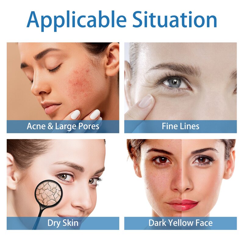 CO2 Bubble Facial Machine Manufacturer - 3-in-1 Hydro Oxygen Jet for Skin Rejuvenation US/IT/ZA