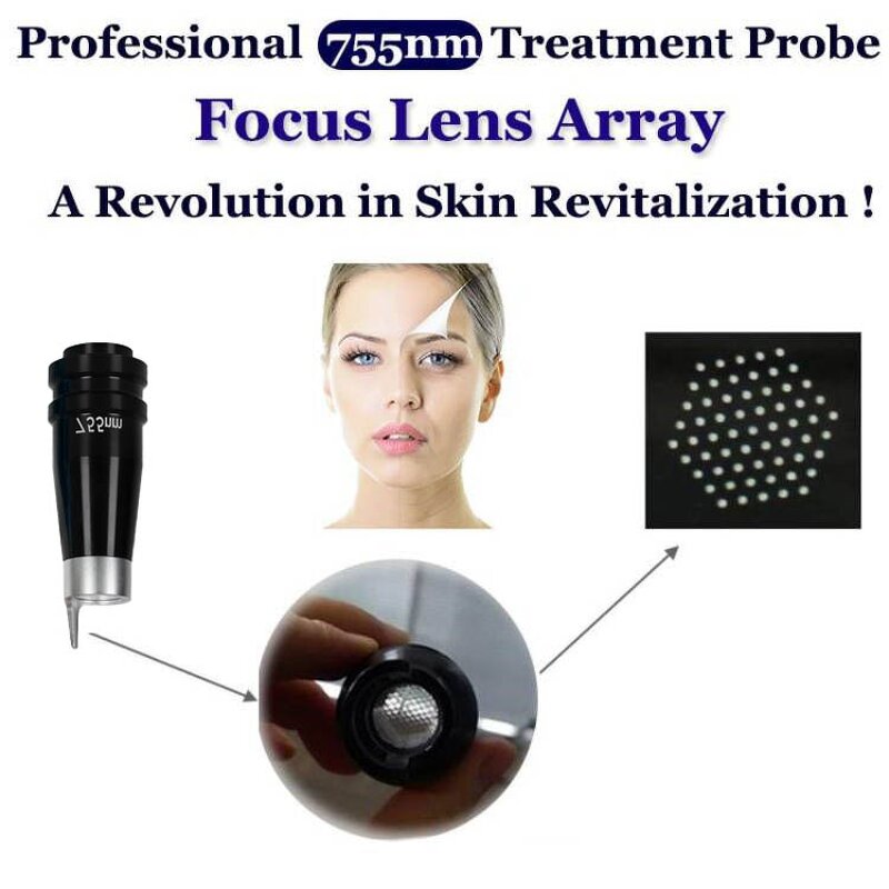 Laser Head Manufacturer - Professional Q Switched 755nm ND YAG for Acne & Tattoo