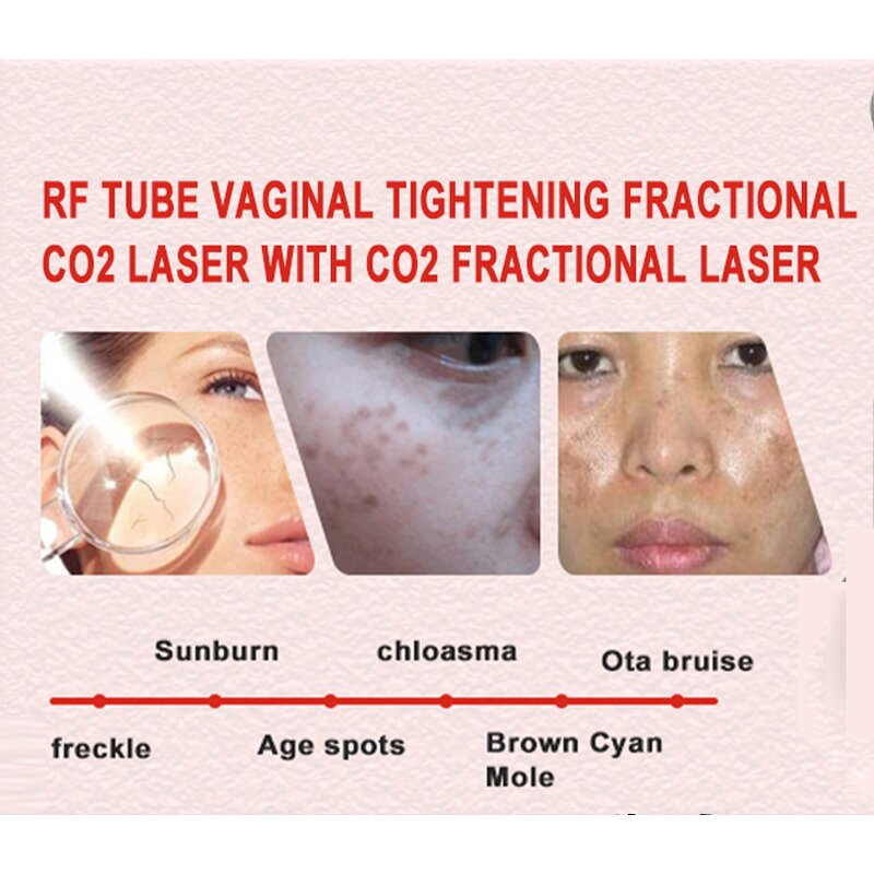 CO2 Laser Machine Manufacturer - Portable Diode for Vaginal Tightening Skin Resurfacing