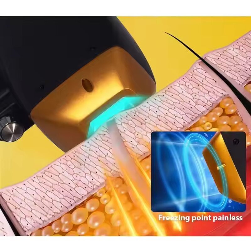 Diode Laser Machine Manufacturer - Professional Desktop 755 808 1064 for Hair Removal