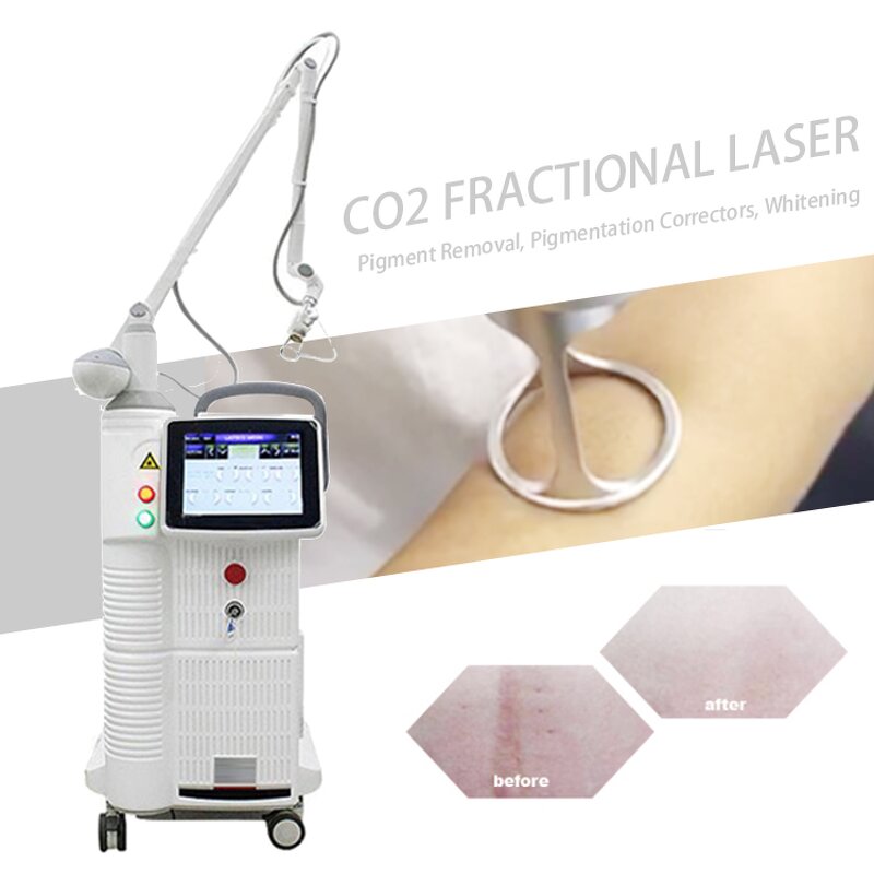 CO2 Laser Beauty Equipment Manufacturer - Fractional for Stretch Mark and Scar Removal