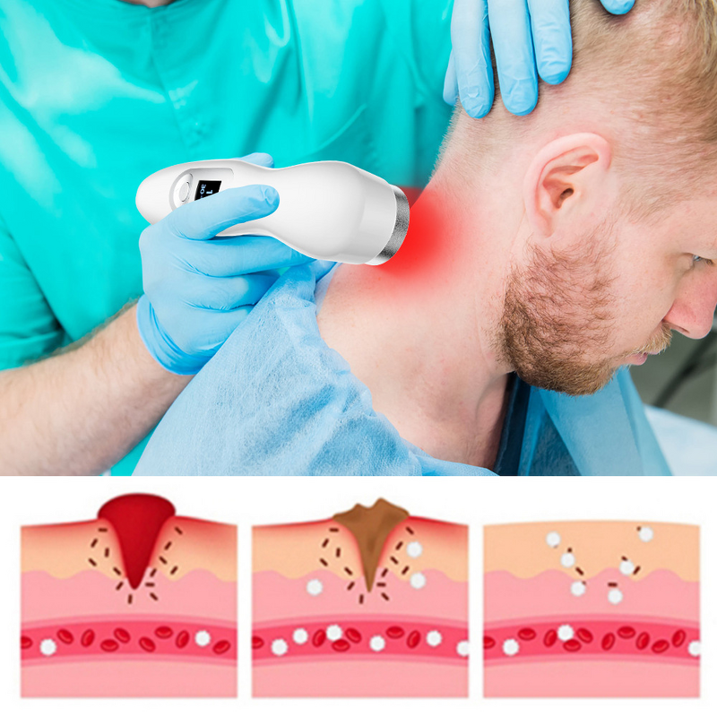 LED Red Light Laser Lamp Manufacturer - Portable Handheld Near-Infrared Home Medical