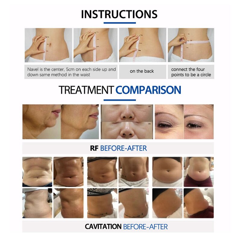 Cavit Machine Manufacturer - Newest 40k 80k for Body Hand Face Sculpting Fat Reduction